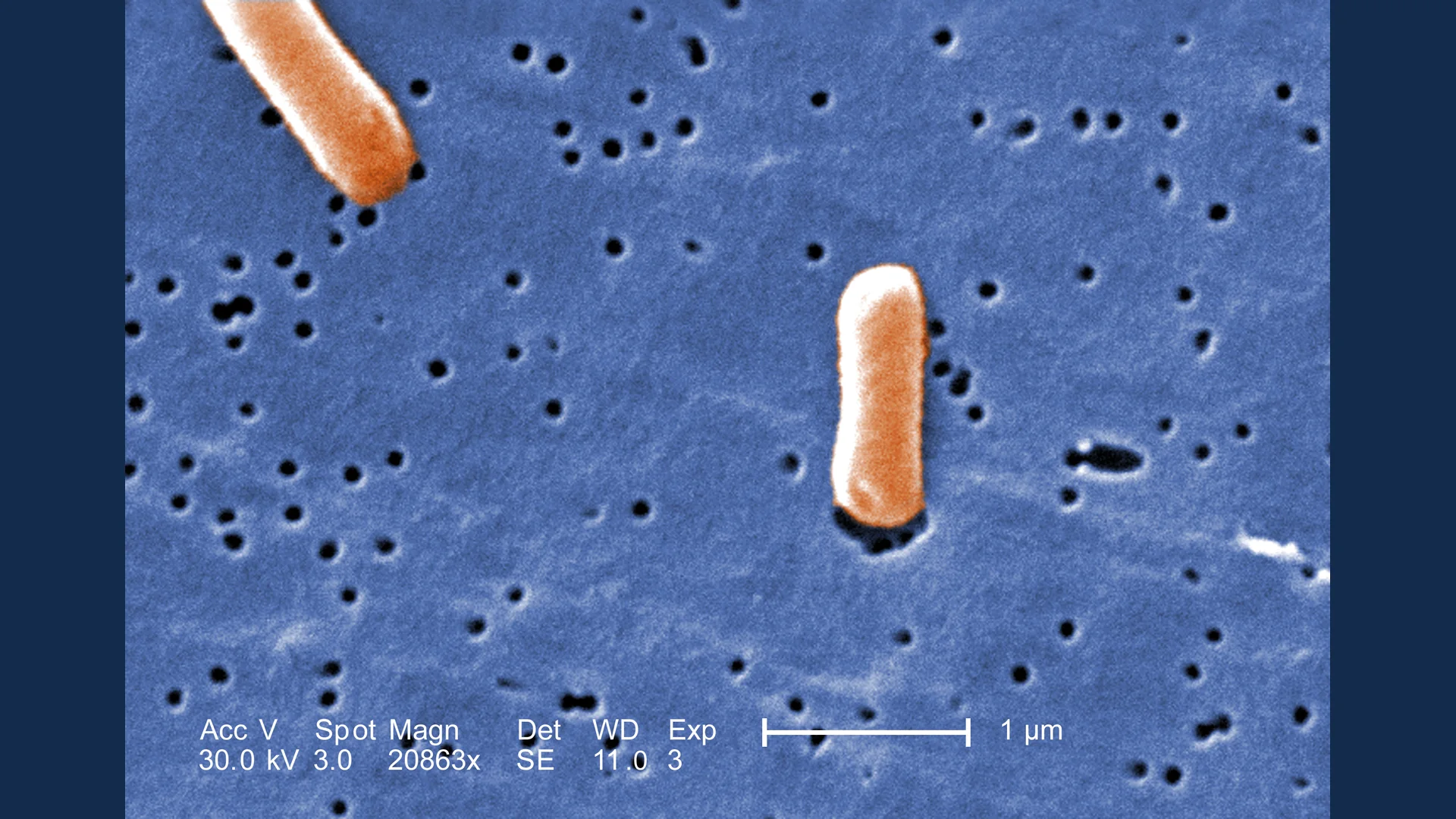 Southampton Salmonella Outbreak Lawyer